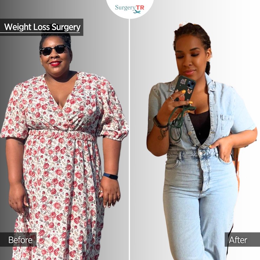 SurgeryTR - Istanbul - SurgeryTR - Istanbul