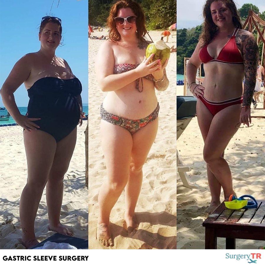 SurgeryTR - Istanbul - SurgeryTR - Istanbul