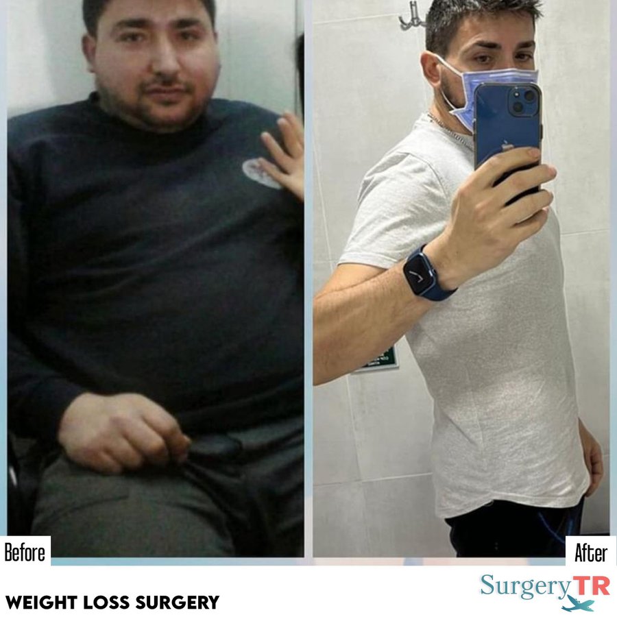 SurgeryTR - Istanbul - SurgeryTR - Istanbul