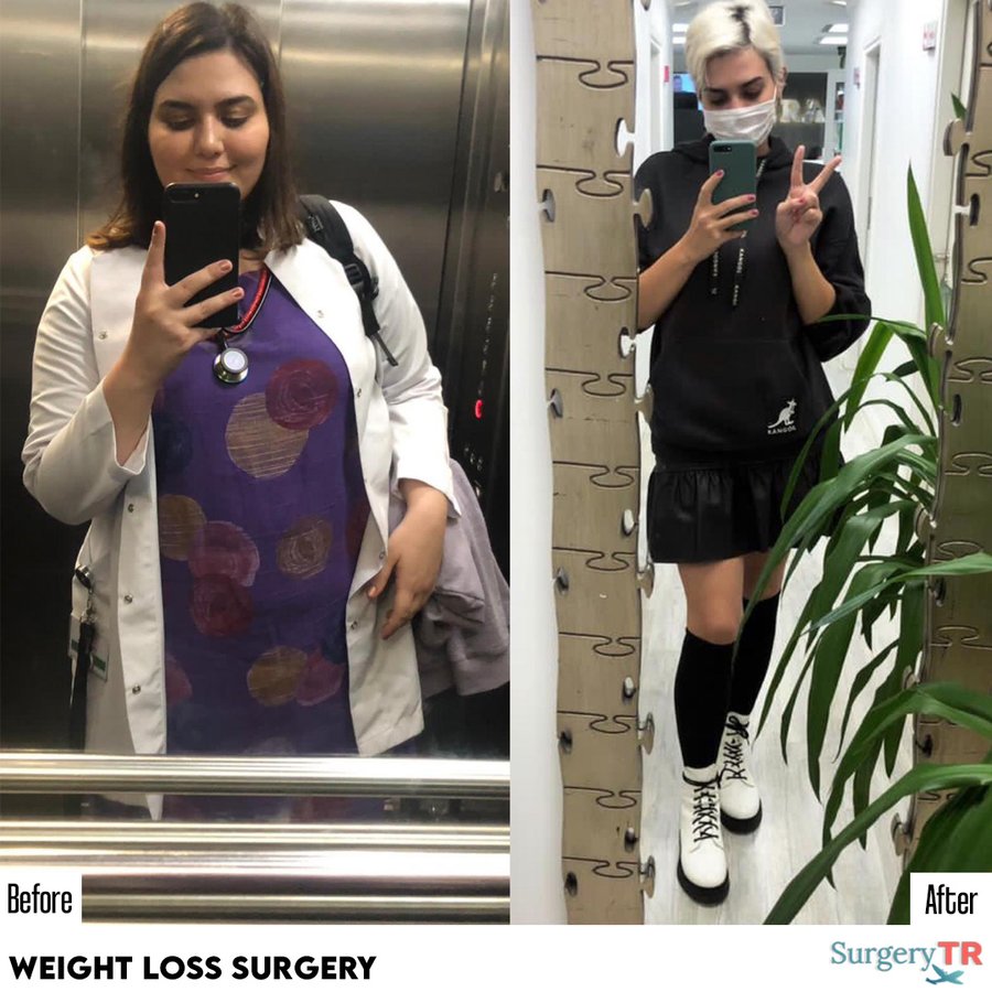 SurgeryTR - Istanbul - SurgeryTR - Istanbul