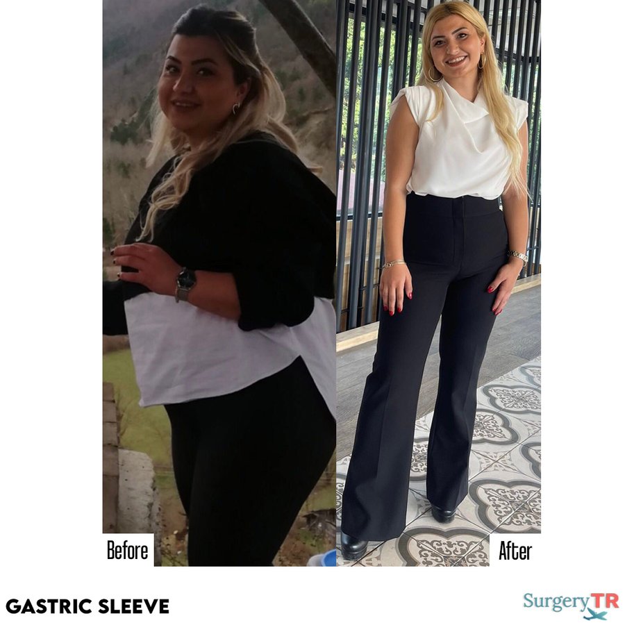 SurgeryTR - Istanbul - SurgeryTR - Istanbul