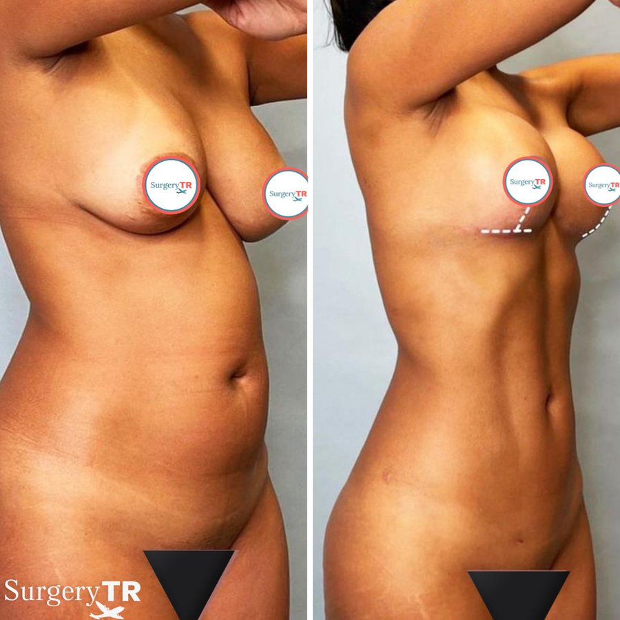 SurgeryTR - Istanbul - SurgeryTR - Istanbul