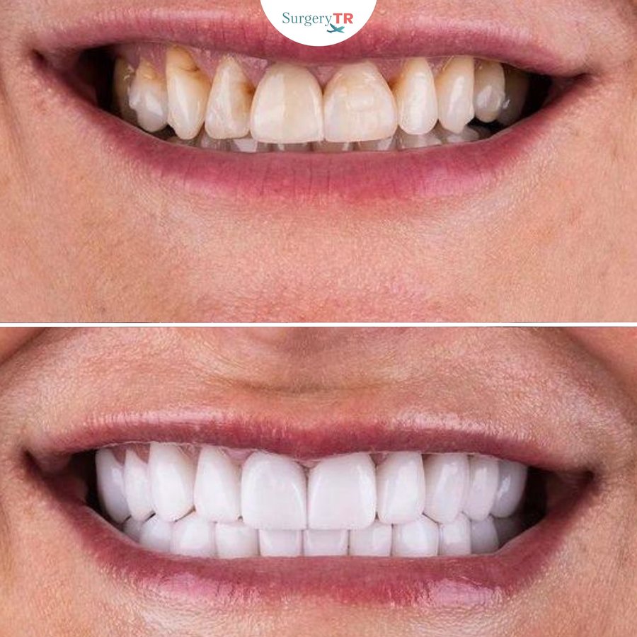 SurgeryTR - Istanbul - SurgeryTR - Istanbul