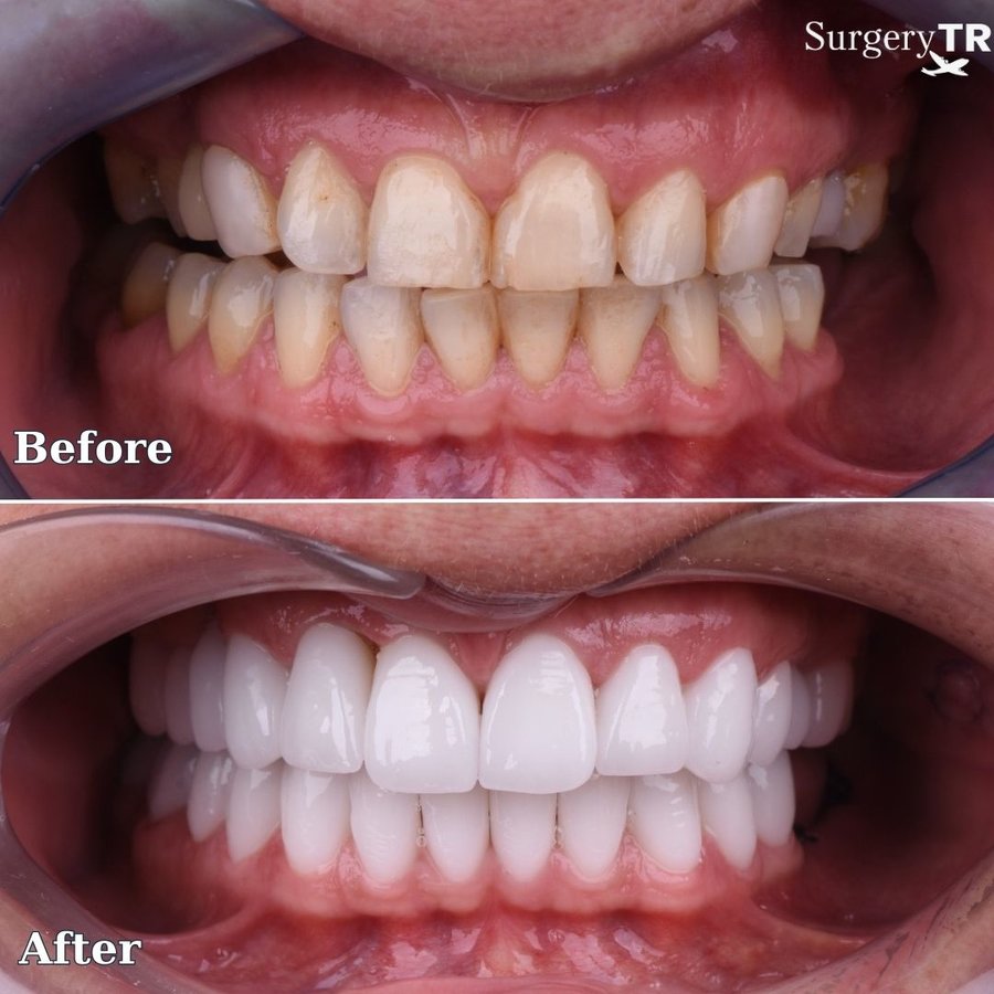 SurgeryTR - Istanbul - SurgeryTR - Istanbul