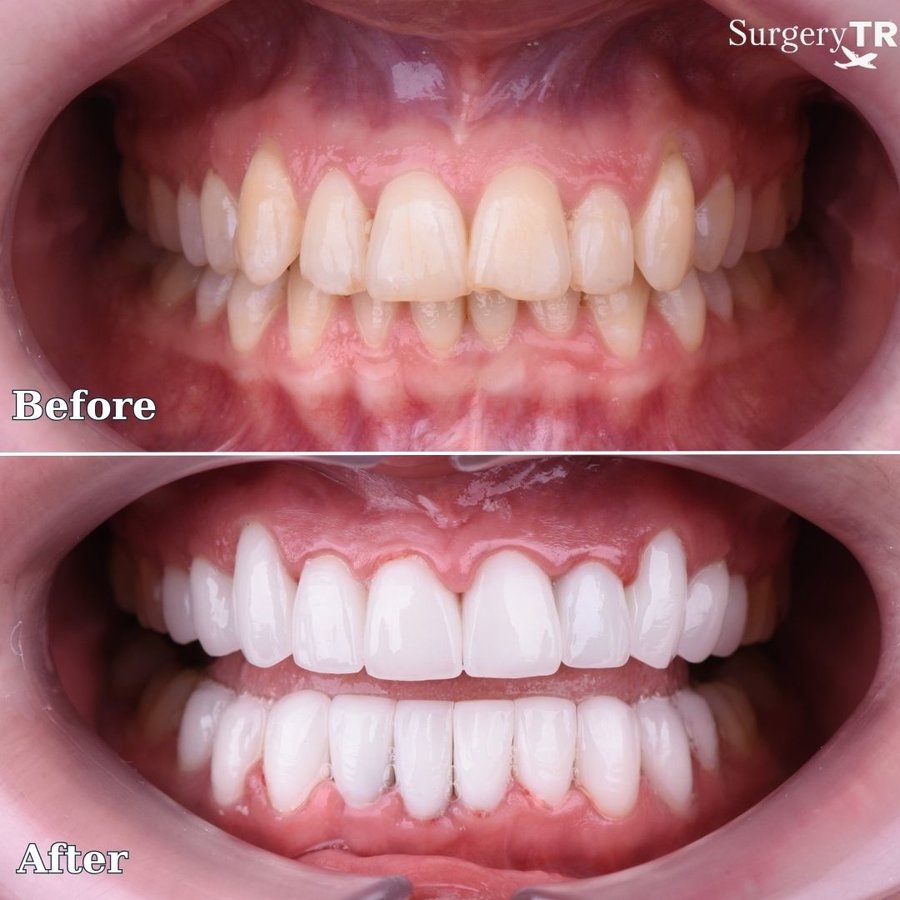 SurgeryTR - Istanbul - SurgeryTR - Istanbul