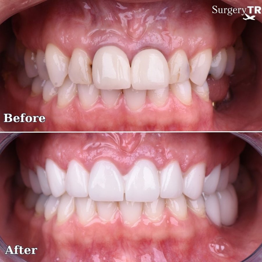 SurgeryTR - Istanbul - SurgeryTR - Istanbul