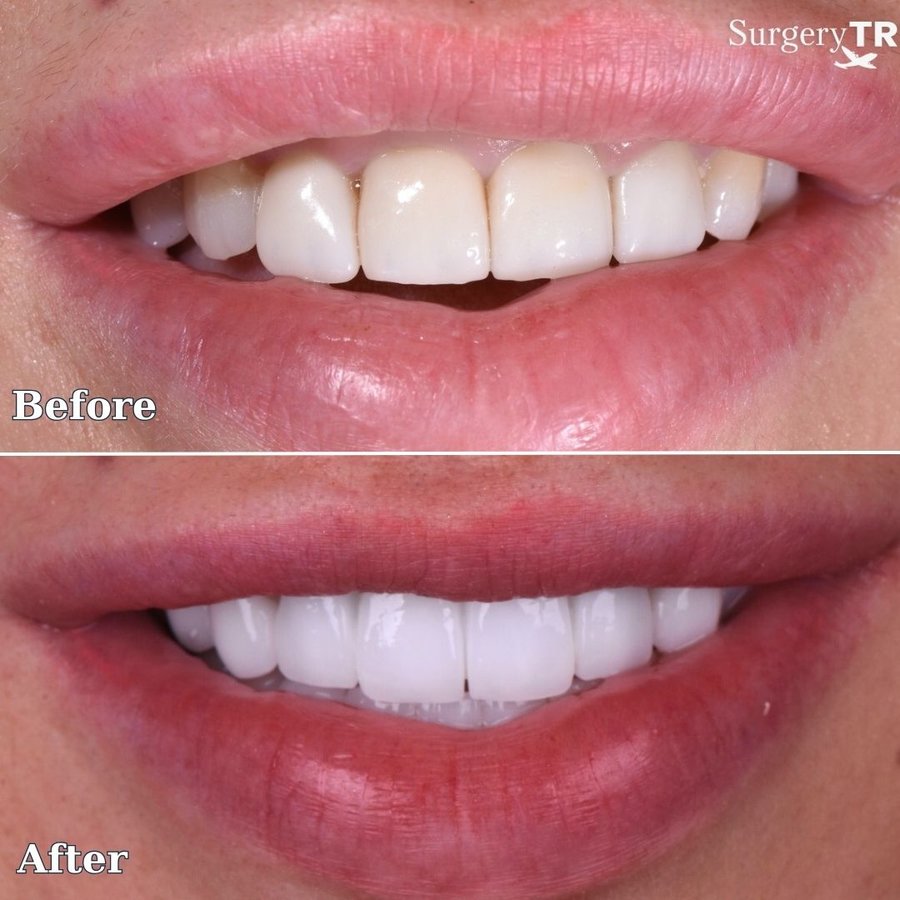 SurgeryTR - Istanbul - SurgeryTR - Istanbul