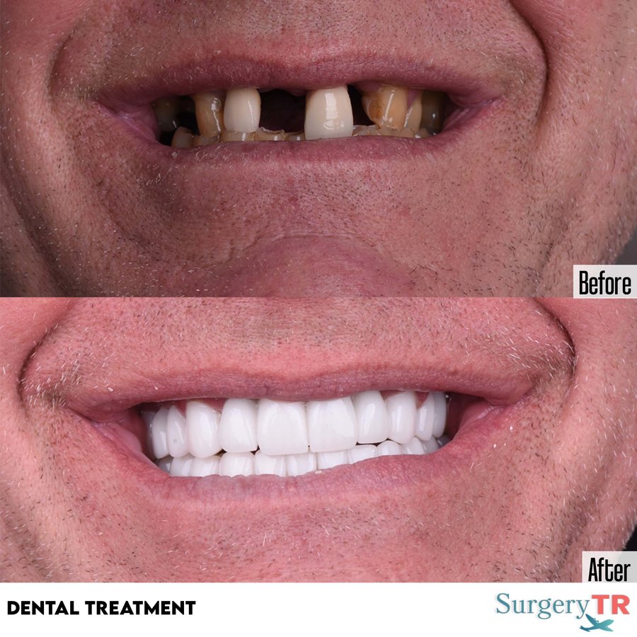 SurgeryTR - Istanbul - SurgeryTR - Istanbul