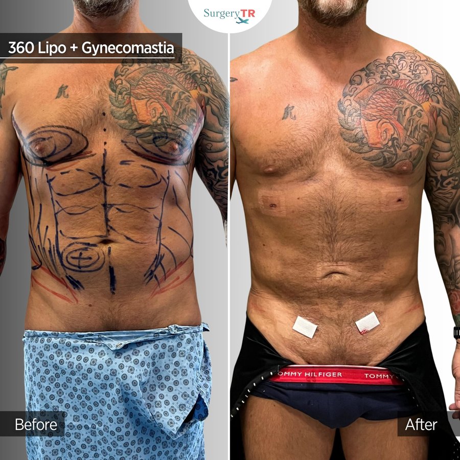 SurgeryTR - Istanbul - SurgeryTR - Istanbul