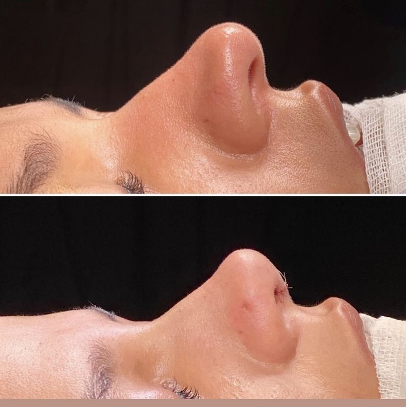 SurgeryTR - Istanbul - SurgeryTR - Istanbul