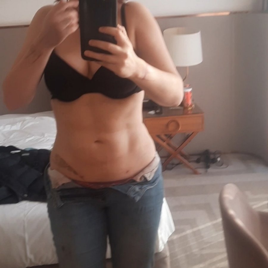 SurgeryTR - Istanbul - SurgeryTR - Istanbul