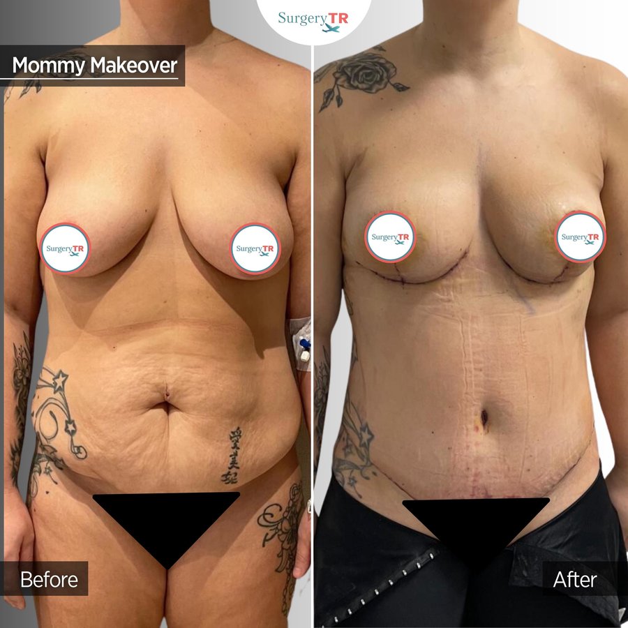 SurgeryTR - Istanbul - SurgeryTR - Istanbul