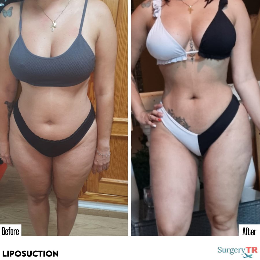 SurgeryTR - Istanbul - SurgeryTR - Istanbul