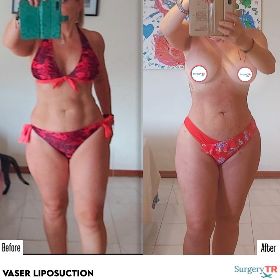 SurgeryTR - Istanbul - SurgeryTR - Istanbul