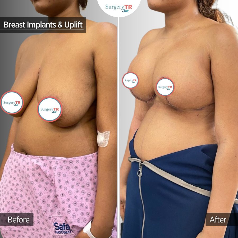 SurgeryTR - Istanbul - SurgeryTR - Istanbul