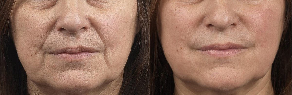 Surrey Skin Care - CEDA Healthcare - Surrey Skin Care - CEDA Healthcare