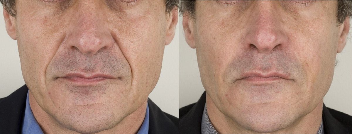 Surrey Skin Care - CEDA Healthcare - Surrey Skin Care - CEDA Healthcare