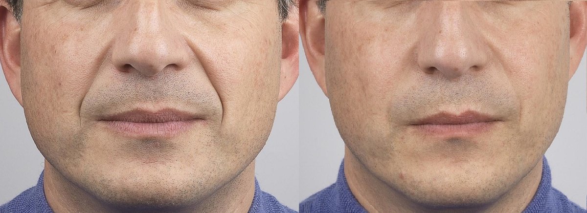 Surrey Skin Care - CEDA Healthcare - Surrey Skin Care - CEDA Healthcare