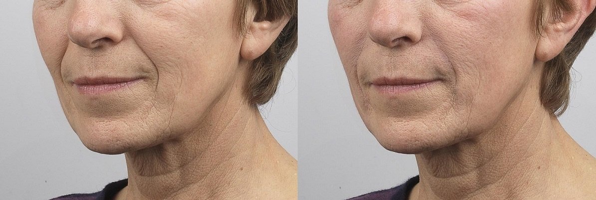 Surrey Skin Care - CEDA Healthcare - Surrey Skin Care - CEDA Healthcare