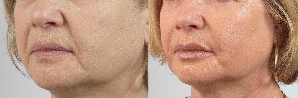 Surrey Skin Care - Surrey Skin Care