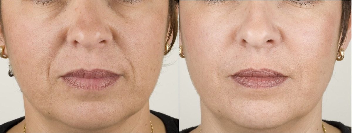 Surrey Skin Care - Surrey Skin Care