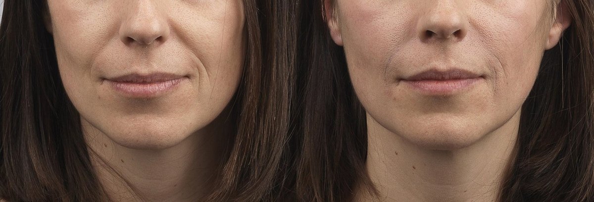 Surrey Skin Care - Surrey Skin Care