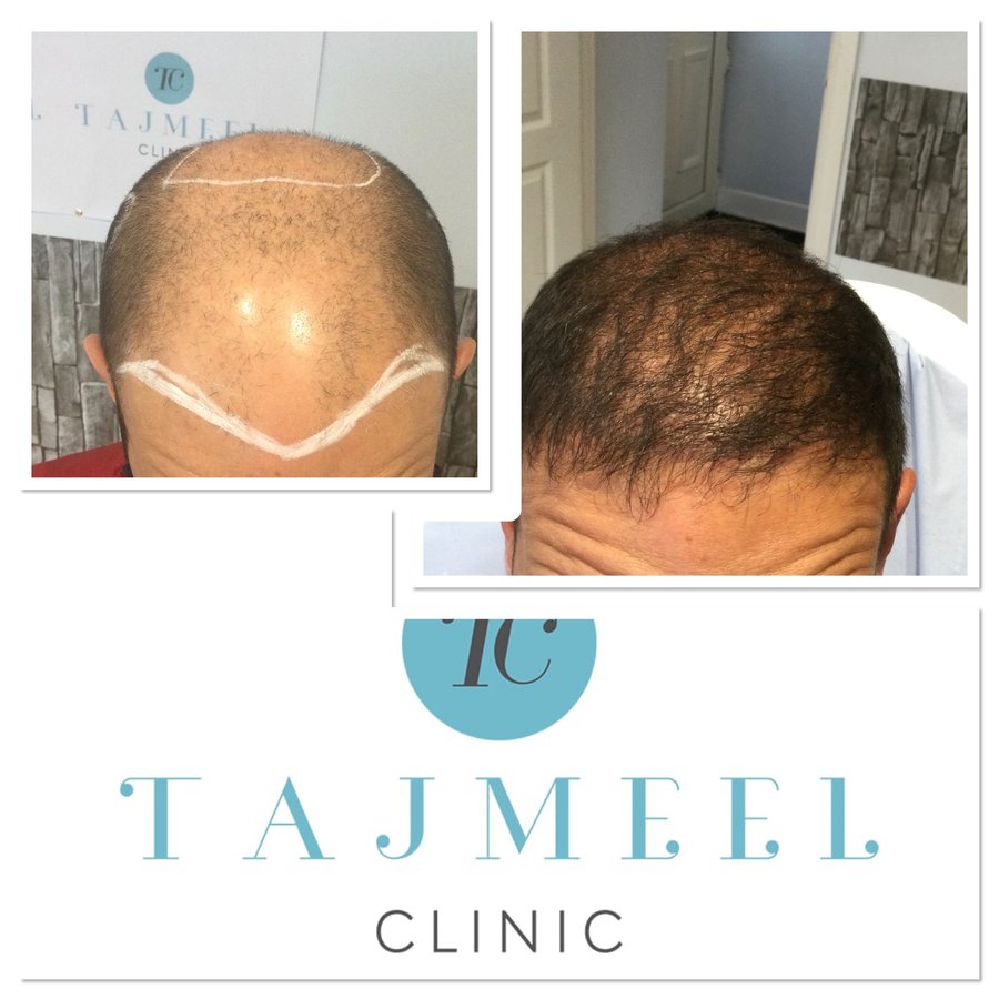 Tajmeel Clinic- Bournemouth, UK - Tajmeel Clinic- Bournemouth, UK