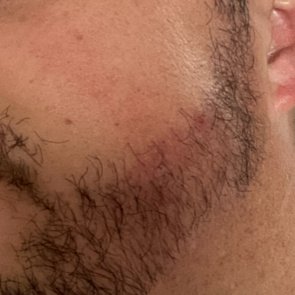 Tajmeel Clinic- Bournemouth, UK - Tajmeel Clinic- Bournemouth, UK