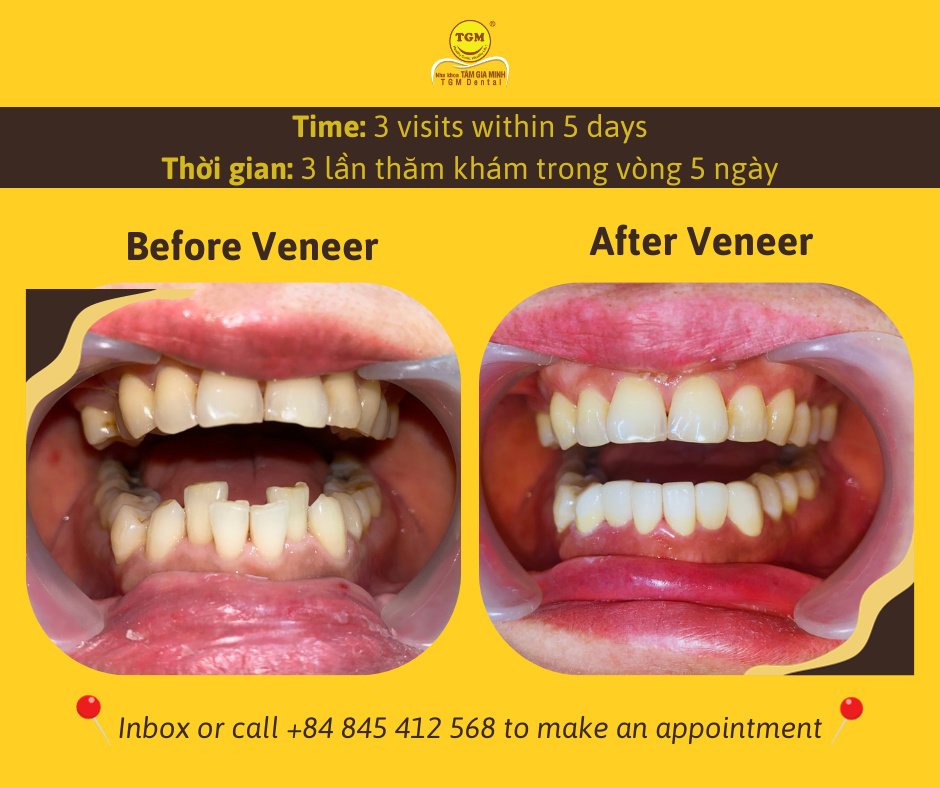 TGM Dental - Da Nang Branch - TGM Dental - Da Nang Branch