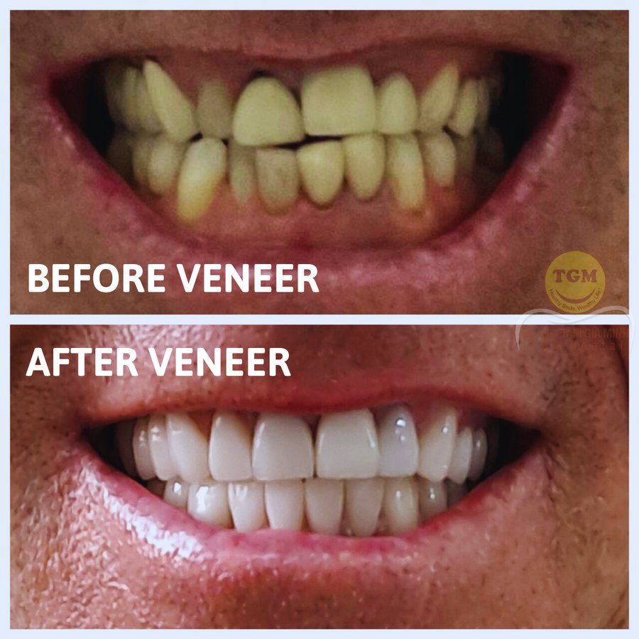 TGM Dental - Da Nang Branch - TGM Dental - Da Nang Branch