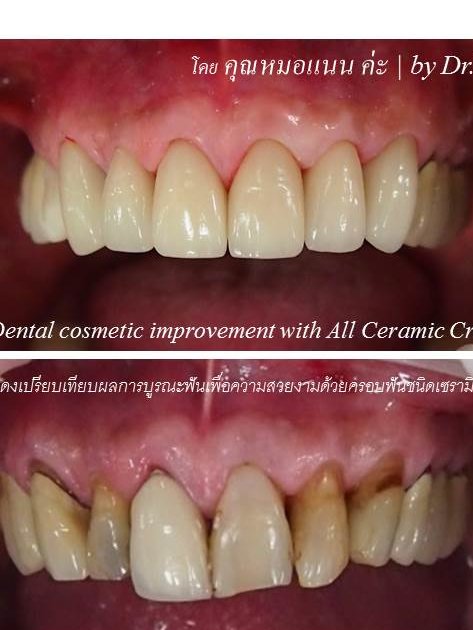 Thai Smile Dental Clinic Pattaya - Thai Smile Dental Clinic Pattaya