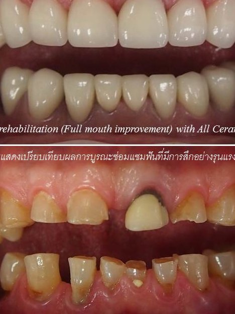 Thai Smile Dental Clinic Pattaya - Thai Smile Dental Clinic Pattaya