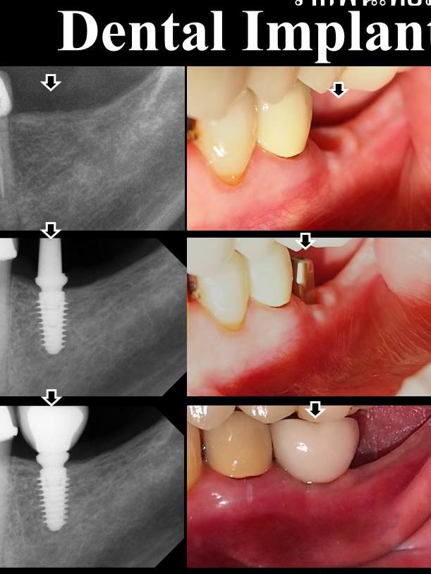 Thai Smile Dental Clinic Pattaya - Thai Smile Dental Clinic Pattaya