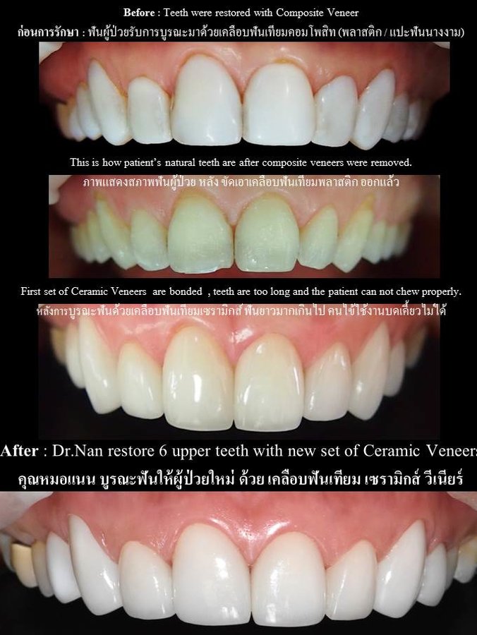 Thai Smile Dental Clinic Pattaya - Thai Smile Dental Clinic Pattaya