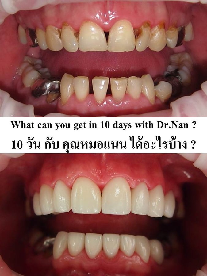Thai Smile Dental Clinic Pattaya - Thai Smile Dental Clinic Pattaya
