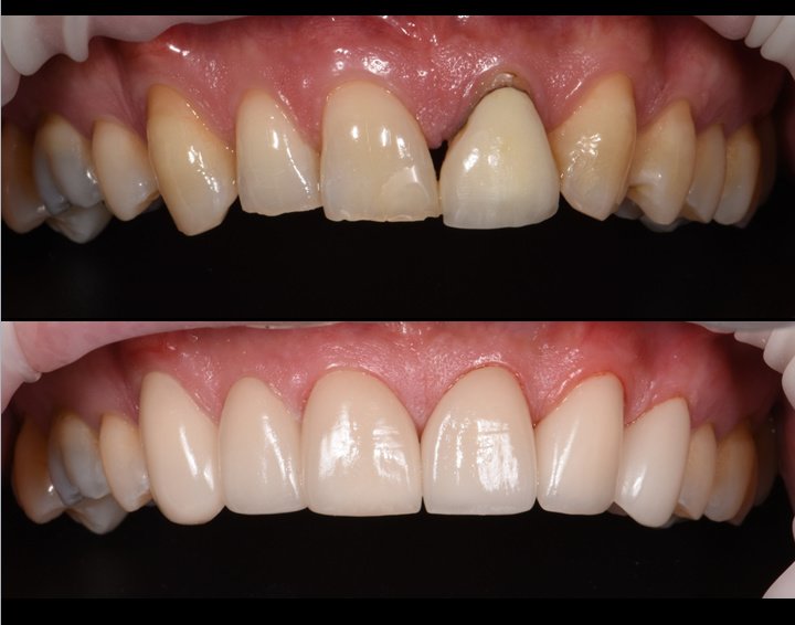 Thai Smile Dental Clinic Pattaya - Thai Smile Dental Clinic Pattaya