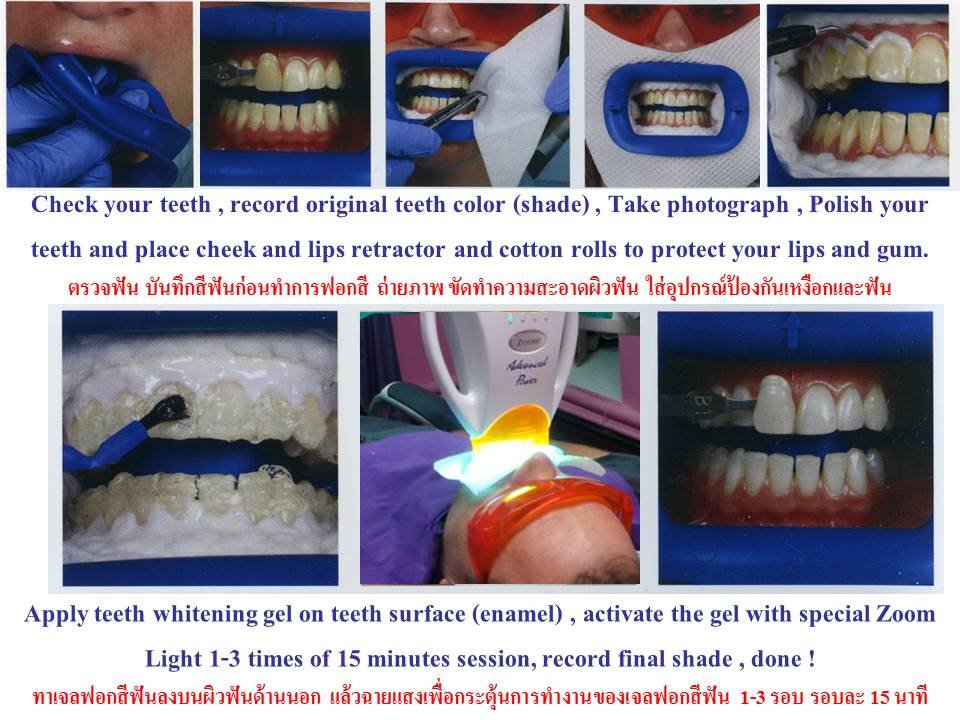 Thai Smile Dental Clinic Pattaya - Thai Smile Dental Clinic Pattaya
