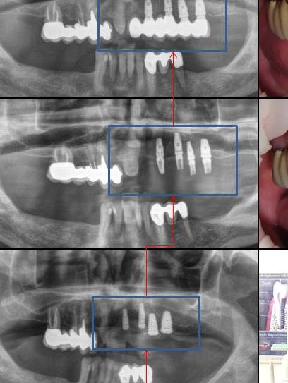 Thai Smile Dental Clinic Pattaya - Thai Smile Dental Clinic Pattaya