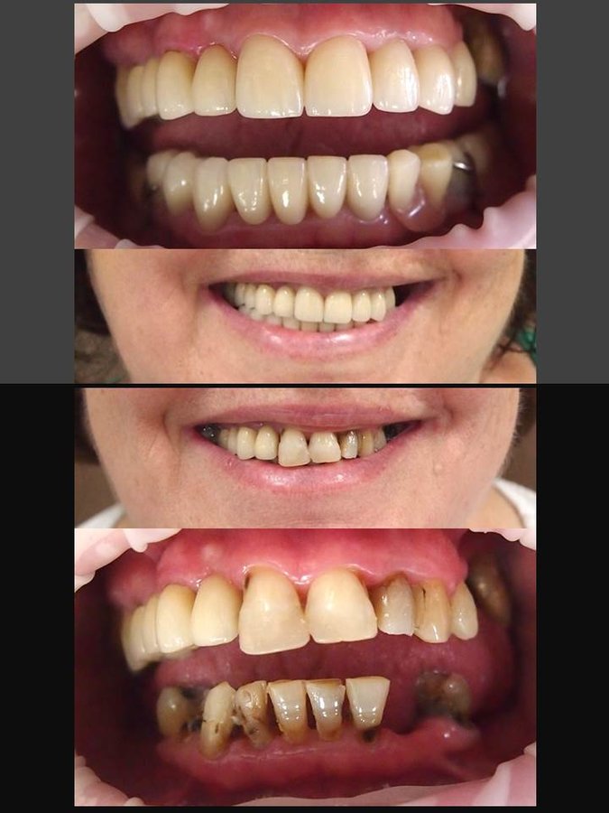 Thai Smile Dental Clinic Pattaya - Thai Smile Dental Clinic Pattaya