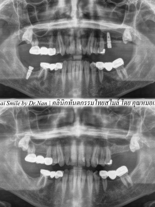 Thai Smile Dental Clinic Pattaya - Thai Smile Dental Clinic Pattaya