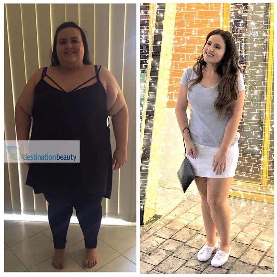 Thailand Gastric Sleeve Center - Thailand Gastric Sleeve Center