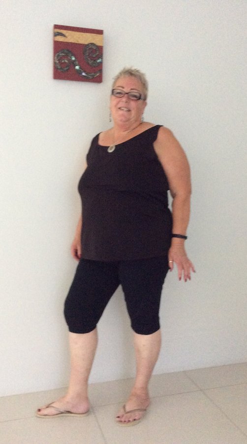 Thailand Gastric Sleeve Center - Thailand Gastric Sleeve Center