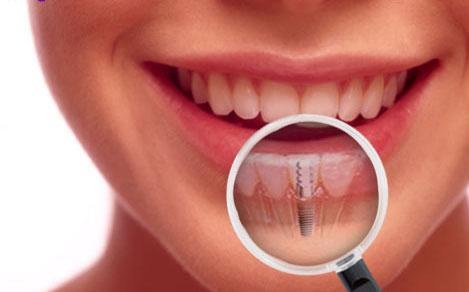 Thangams Dental Implant Center - Thangams Dental Implant Center