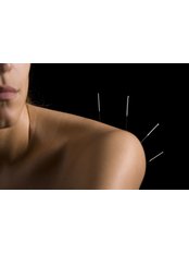 The Acupuncture Pain Centre - The Acupuncture Pain Centre