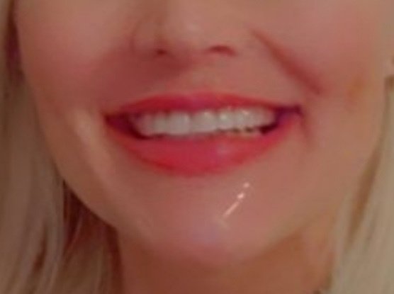 The All on X Dental Studio - The All on X Dental Studio