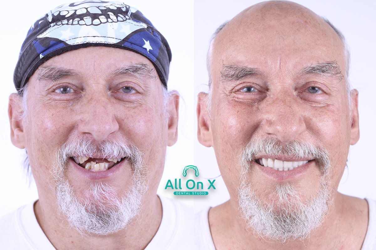 The All on X Dental Studio - The All on X Dental Studio