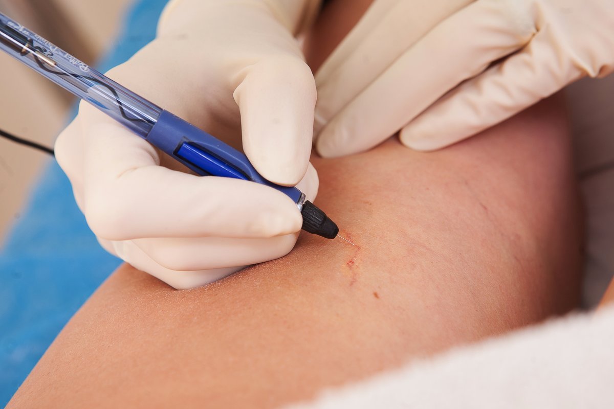 The Baltic Vein Clinic - The Baltic Vein Clinic