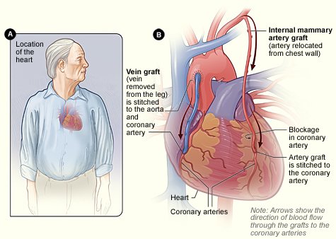 جراح القلب - The Cardiac Surgeon