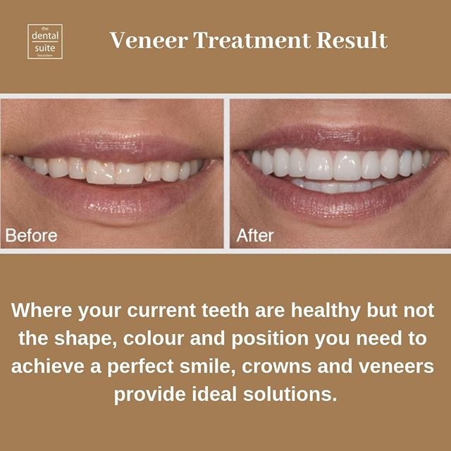 The Dental Suite Hounslow - The Dental Suite Hounslow