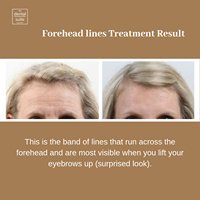 The Dental Suite Hounslow - The Dental Suite Hounslow